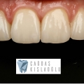Dr.Çağdaş Kışlaoğlu Diş Hekimi | Protez Uzmanı
